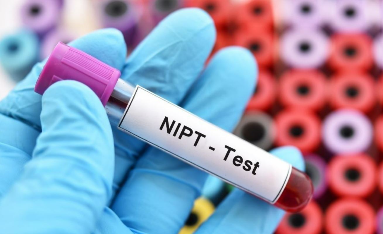 Pengertian dan Prosedur NIPT Test